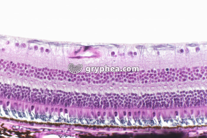 Rétine CT x100 - gryphea.org